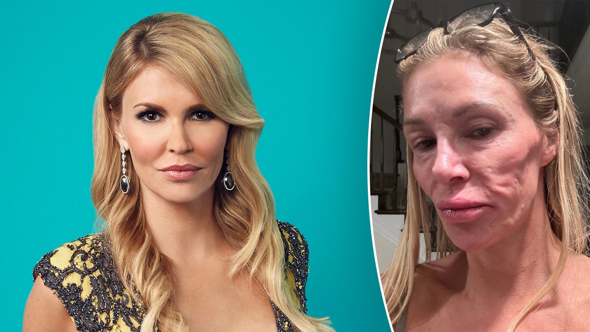 Brandi Glanville shares stripped down photo as she claims her 'looks - Brandi Glanville Net Worth: From Housewife To Hot Headlines