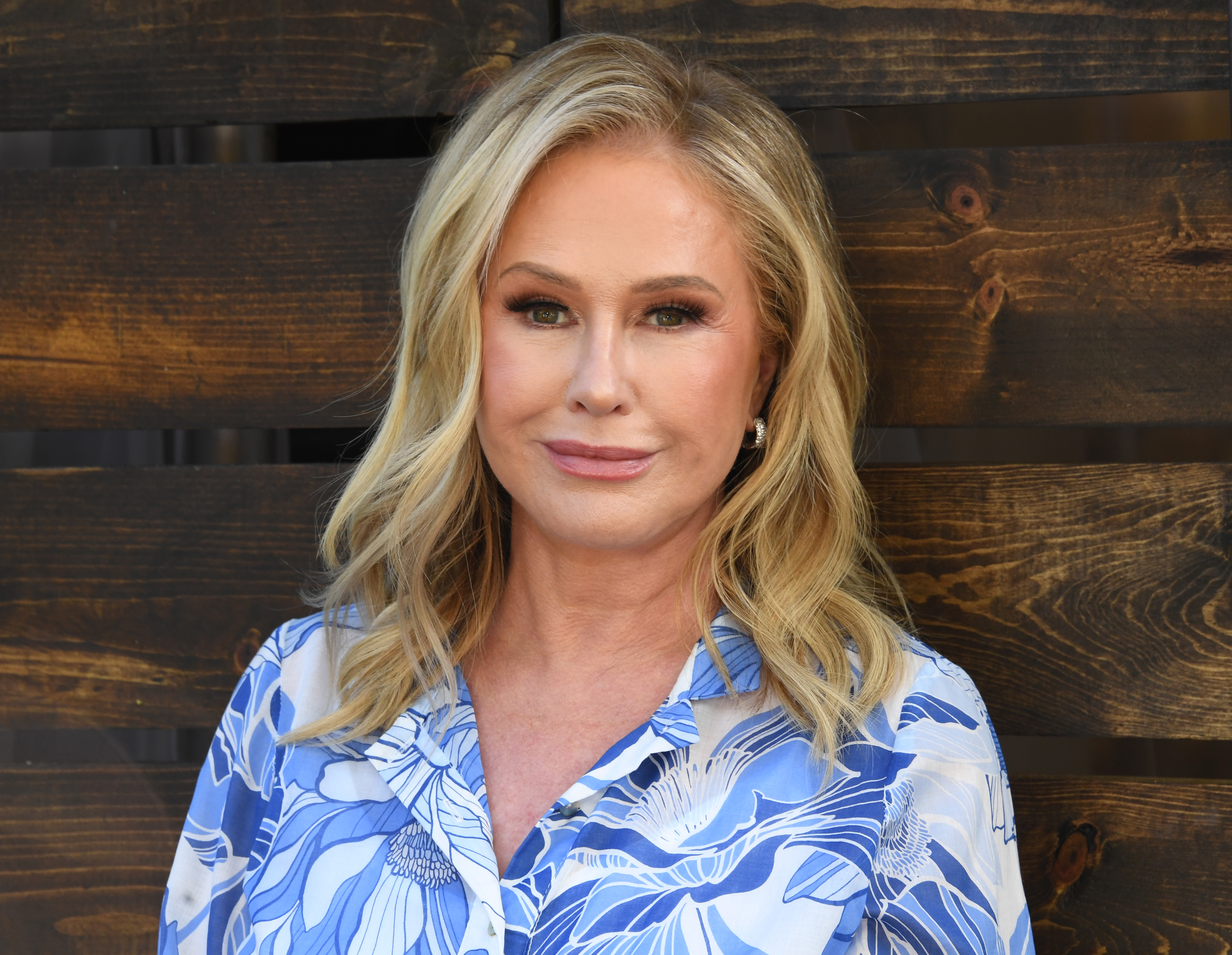 Is Kathy Hilton's Baked Potato With Caviar Healthy? - Kathy Hilton Net Worth: Hilton Heiress & RHOBH Icon