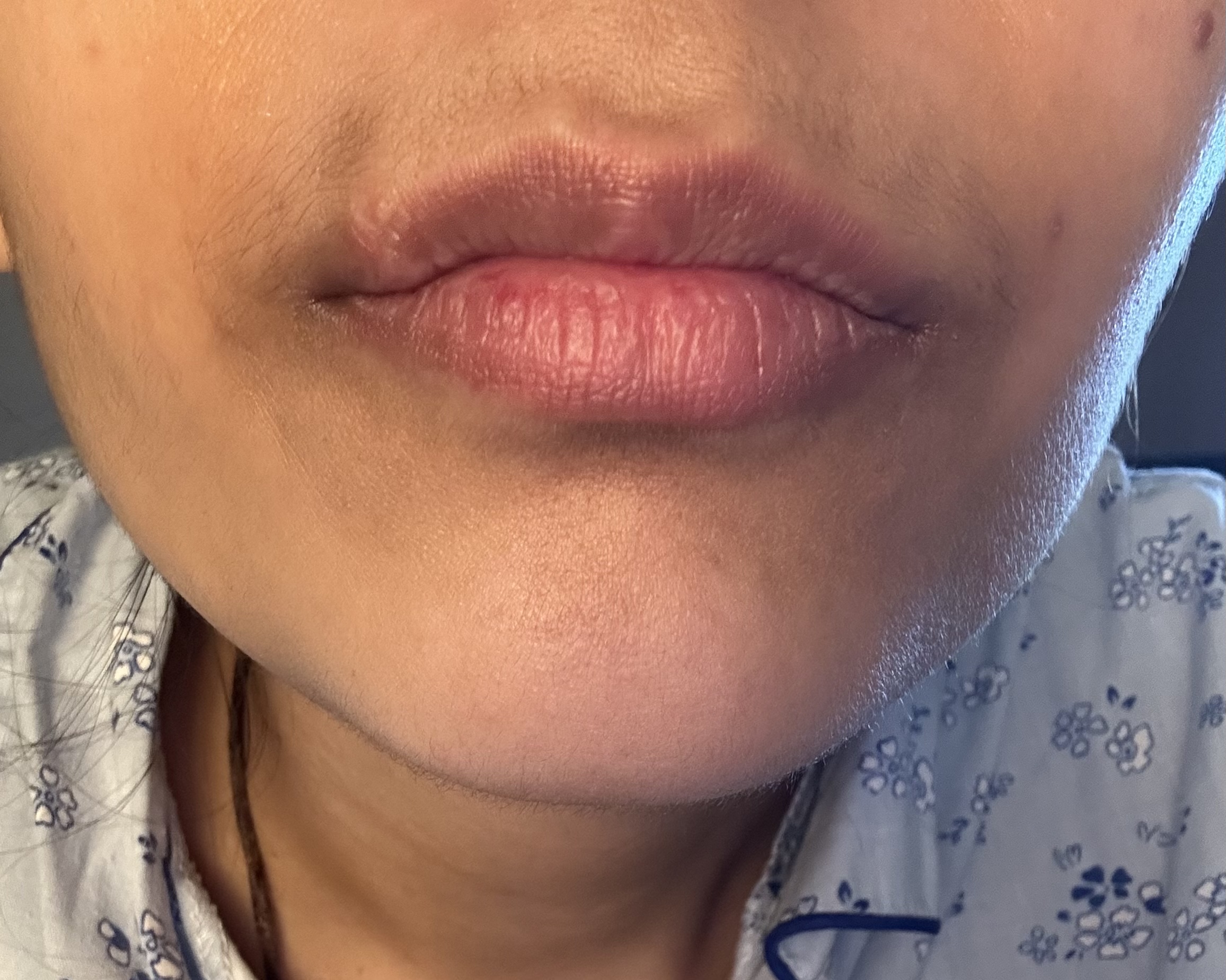 How Tall Is Scar Lip? Rising Rap Star's Height Uncovered