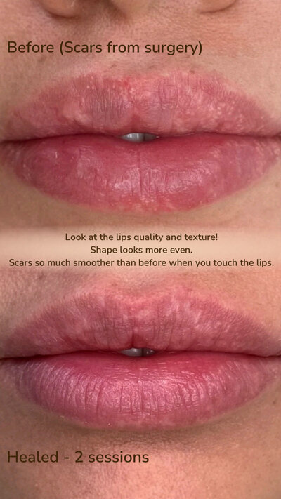 Lip Scar - How Tall Is Scar Lip? Rising Rap Star's Height Uncovered