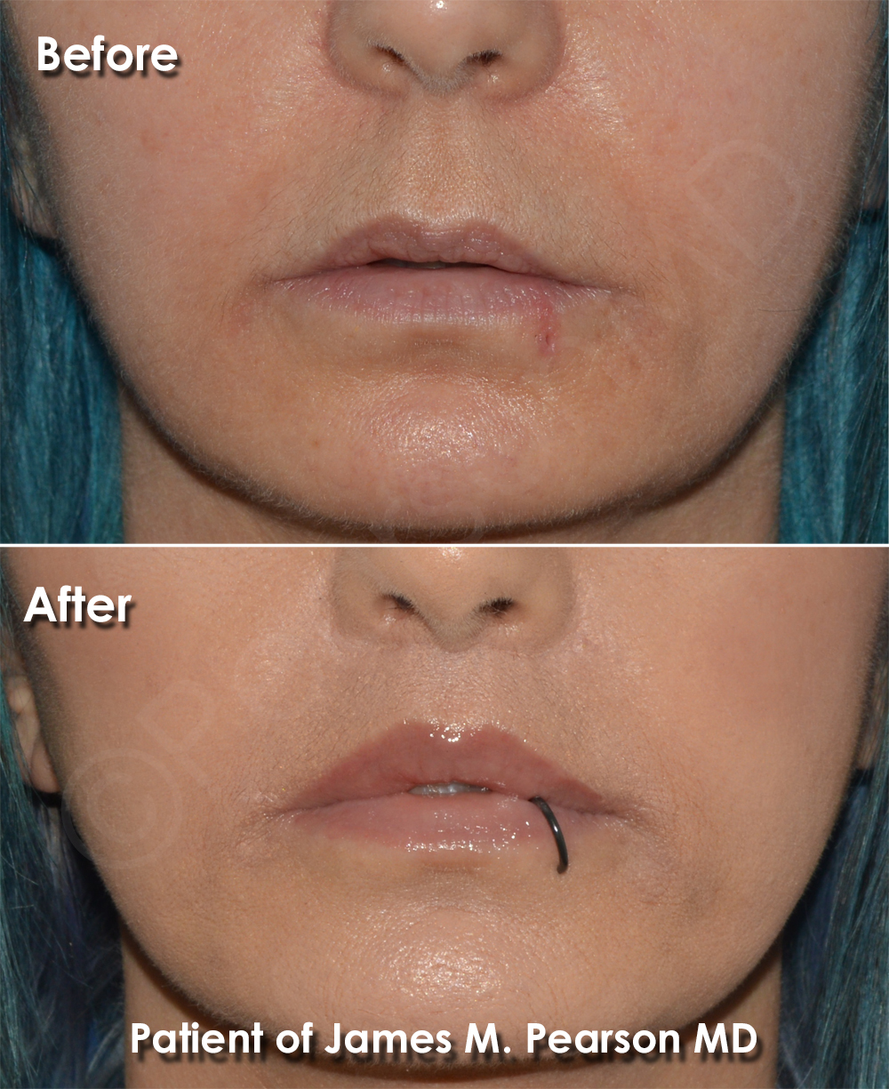 Lip Scar - How Tall Is Scar Lip? Rising Rap Star's Height Uncovered
