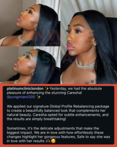 Rapper Yung Miami Unveils New Face .. After Massive Plastic Surgery! - How Old Is Yung Miami? City Girls Rapper’s Age Uncovered