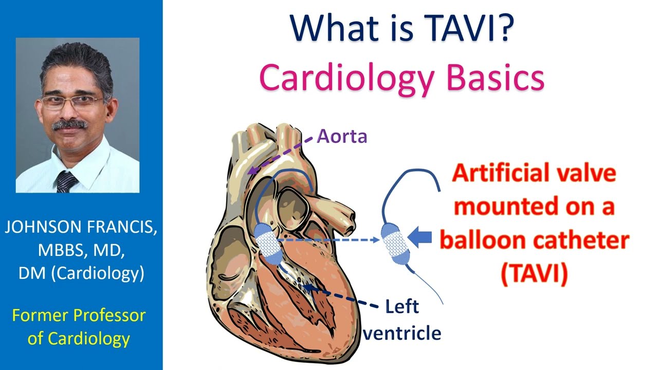 What is TAVI? Cardiology Basics - YouTube - How Old Is Tavi Baby from Baddies? Find Out Her Age